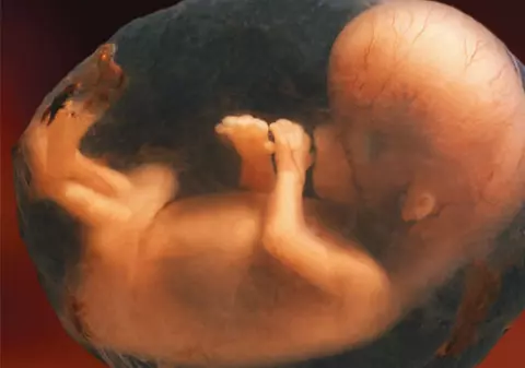 Un tailandez transporta fetuşi înveliţi în aur pentru ai folosi la magie neagră