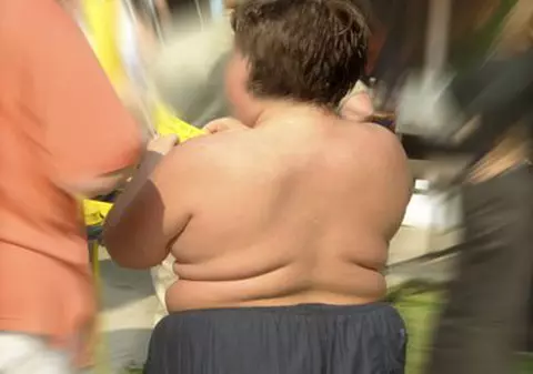 Copiii născuţi prin cezariană au şanse mai mari să devină obezi