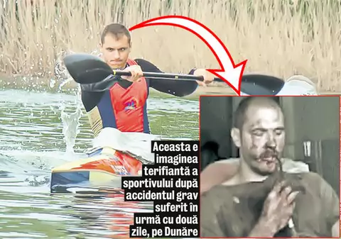 Desfigurat! Kaiacistul Iustin Porcăraşu a suferit un grav accident, pe Dunăre | VIDEO