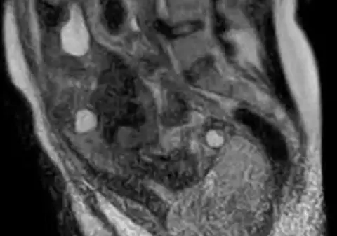 SUPERB sau DIZGRAŢIOS? Alege! Radiografia unei naşteri te va... uimi | VIDEO