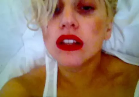 Uite în ce hal arată Lady Gaga, după ce a fost lovită de o bară uriașă, într-un concert! E machiaj sau e pe bune?