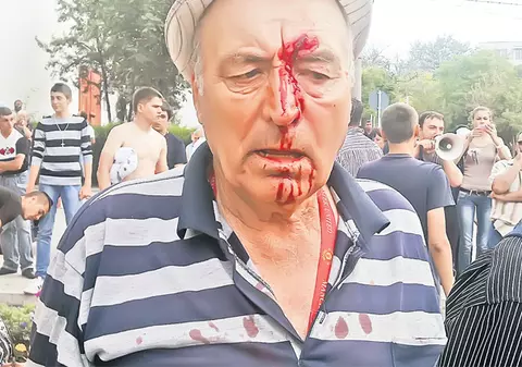 Un pensionar din Năvodari, snopit în bătaie de susţinătorii unui candidat