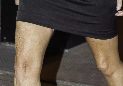 IMAGINE DE COŞMAR! Diva de la Hollywood pe care o adorai, cu PIELEA ZBÂRCITĂ pe picioare | FOTO INCREDIBIL