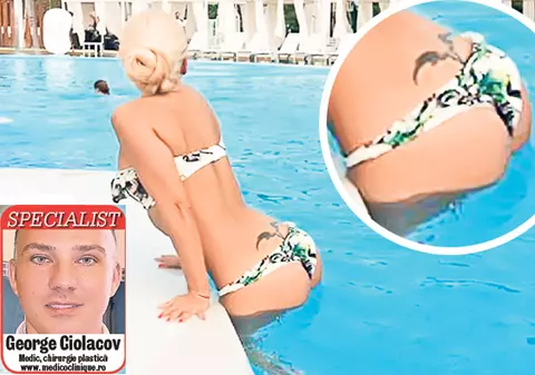 Anda Adam şi-a făcut injecții în fese? Medicul estetician George Ciolacov a analizat câteva poze cu vedete în costume de baie