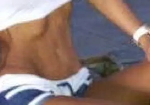 Imaginea ȘOCANTĂ a unei vedete de la noi. Observi vreo diferență între ea și o ANOREXICĂ?