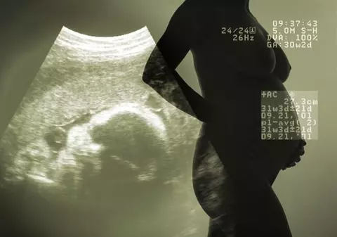 Statistică tragică! Sute de mii de femei mor anual pentru că nu au acces la contracepție