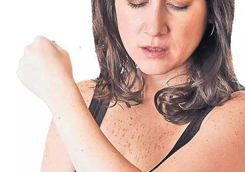 Ardeiul iute alungă durerile articulare