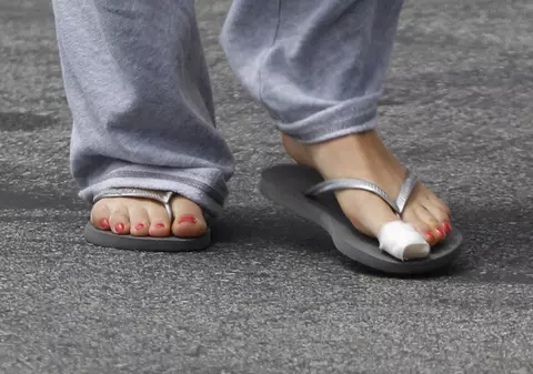 Americanii au făcut o nouă obsesie! Cea mai în vogă operaţie estetică: SUBŢIEREA DEGETELOR MARI de la picioare!