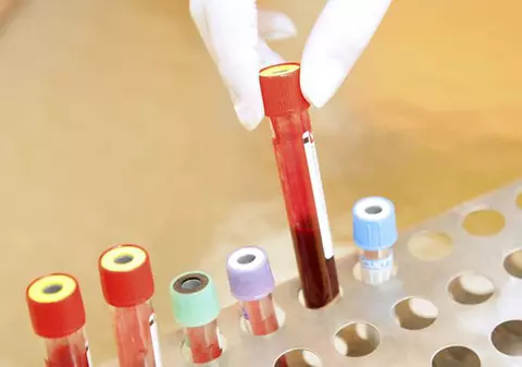 EXCLUSIV/ Drama unui seropozitiv român. Nu este primit nici măcar în magazinul de la colțul blocului