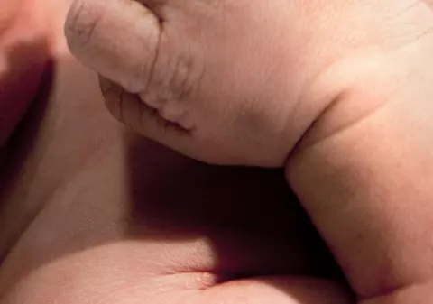 CAZ ŞOCANT! Comportamentul INCREDIBIL al unui bebeluş cu două capete