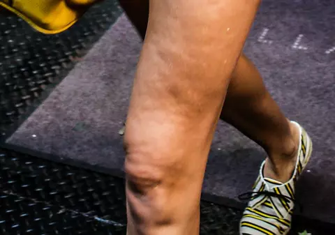 La banii ei, e INADMISIBIL! Vedeta IMPECABILĂ e, de fapt, un DEZASTRU. Defilează cu o celulită odioasă | FOTO