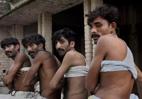 Ca să scape de sărăcie, îşi dau rinichiul pe 800 €