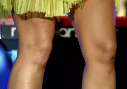 La valoarea ei, NU AVEA VOIE s-o comită! Cu BUBE PE PICIOARE şi ROCHIA RUPTĂ: aşa S-A FĂCUT DE RÂS, ÎN PUBLIC, o vedetă îndrăgită de la noi | FOTO