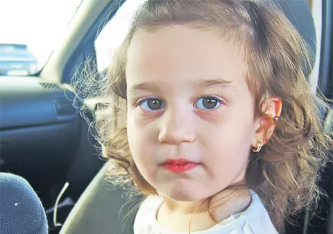 Fetiţa cu «gâlma» cât un cancer