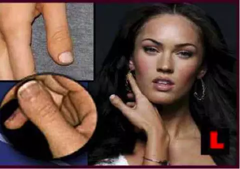 Top 10 vedete cu defecte fizice vizibile