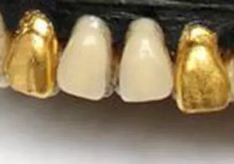 Se poate mai HIDOS? Pantofii cu DINȚI ”umani” AURIȚI | FOTO