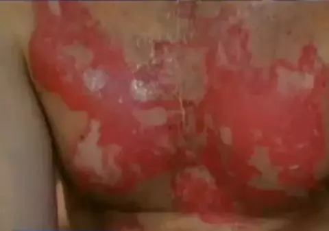 ŞOCANT! Poţi lua foc, încercând să te aperi de cancer!