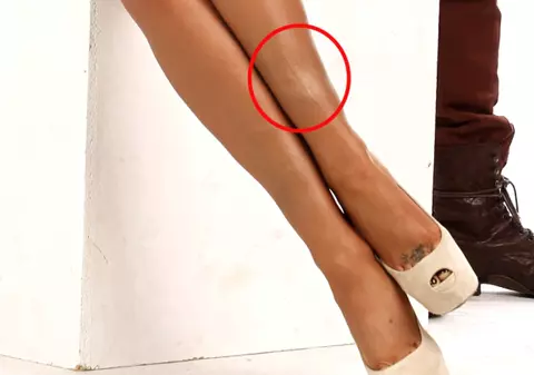 Bianca Drăguşanu, PLINĂ DE VÂNĂTĂI ŞI CICATRICI! Uite cum a apărut în poze | FOTO