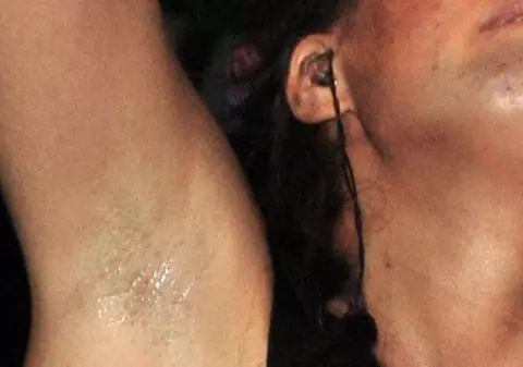 IMAGINE HORROR! O cântăreaţă îndrăgită de la noi, PLINĂ DE BUBE şi NEEPILATĂ! Uite ce apariţie JENANTĂ a avut la un concert | FOTO