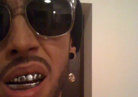 Velea, ce-i cu dinţii ăştia? | FOTO