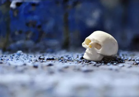 Exista viata dupa moarte? Jurnalul unui neurochirurg | VIDEO
