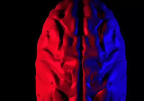 O femeie care era convinsă că soțul o înșală a descoperit că are un chist pe creier care îi cauza paranoia