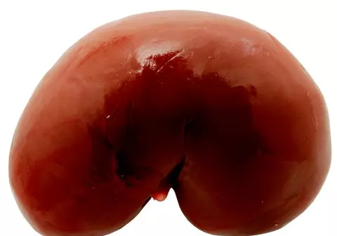 A murit omul care a realizat PRIMUL TRANSPLANT de RINICHI din LUME