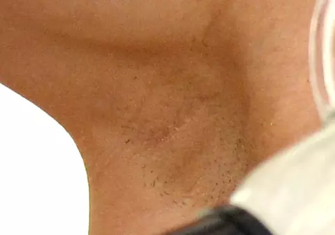 GAFĂ DE PROPORŢII! O VEDETĂ DE TOP de la noi, CU PĂR LA SUBRAŢ, în public! La asta nu te-ai fi aşteptat de la această divă extrem de apreciată | FOTO INCREDIBIL