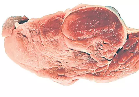 Totul despre carnea de porc