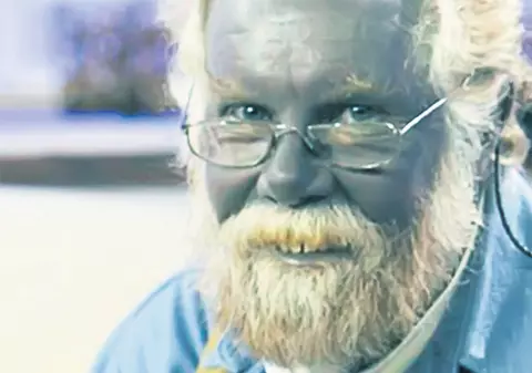 Atenţie! Substanţa care te transformă în ştrumf se vinde la liber