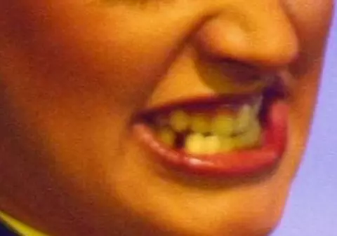 NU o să ghicești NICIODATĂ cine este VEDETA care se STRÂMBĂ și căreia ÎI LIPSESC DOI DINȚI | FOTO