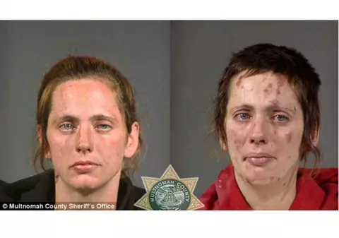 IMAGINI ȘOCANTE! DESFIGURAȚI de DROGURI, în câteva luni | FOTO