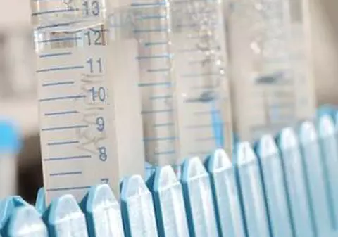 GRIPA AVIARĂ REVINE! ONU trage semnalul de alarmă