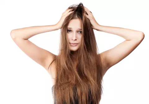 Mătreaţă? Ce jenant! Uite de ce apare şi cum scapi de ea