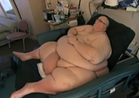 Cel mai gras om din lume a slăbit 300 de kilograme 