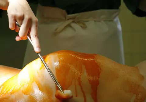 TRAGEDIE! Doi copii fără mamă! Tânăra care a intrat în comă la câteva zile după ce a născut A MURIT