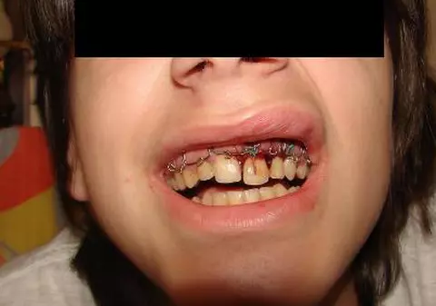 ATENŢIE, IMAGINI ŞOCANTE! Un copil de 12 ani a fost bătut crunt în centrul Buzăului