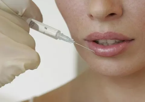Sănătate şi frumuseţe: Totul despre mărirea buzelor cu acid hialuronic