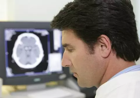 Surprinzător! Opiniile politice sunt vizibile în creier