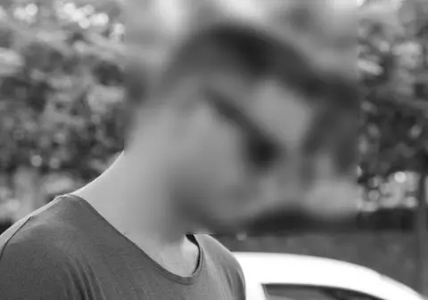 Un alt cântăreț de la noi și-a facut implant de păr: "Acum sunt Harry Potter"