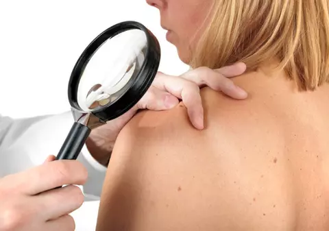 Invenția unui român face furori în toată lumea! A creat o aplicație care detectează cancerul