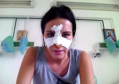 Și-a tăiat nasul degeaba! Cristina Roman, din nou la operație