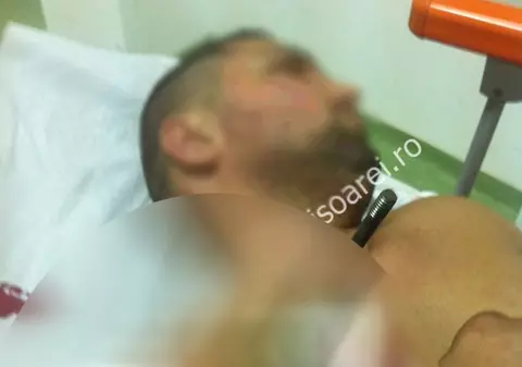 Bătaie cu săbii într-un spital din Timișoara! Interlop internat cu o sabie în umăr – IMAGINI ȘOCANTE 