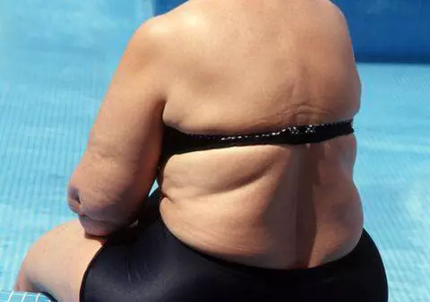 Opinia specialiștilor: Aerul poluat poate cauza obezitate