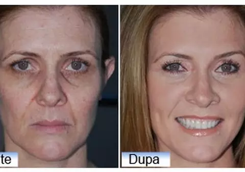 (P) Deşi are 52 ani, arată de 35. Află şi tu cum a reuşit să scape de riduri!