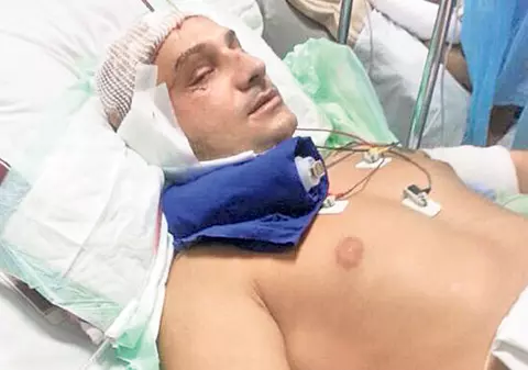 Desfigurat de la o şaorma! Un tânăr din Bucureşti e în stare gravă la spital în urma unui scandal