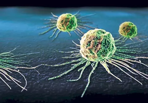 Oamenii de știință australieni susțin că au reușit să oprească răspândirea celulelor canceroase