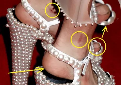 HORROR! O SUPER VEDETĂ, CU MURDĂRIE SUB UNGHII, RĂNI ŞI CĂLCÂIE CRĂPATE! Uite ce apariţie de coşmar a avut în public | FOTO