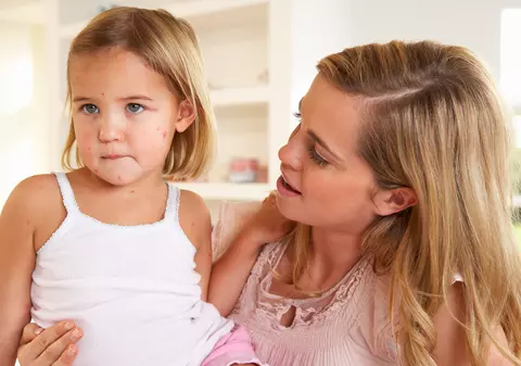 Ministrul Sănătății anunță: Numărul persoanelor care au murit din cauza rujeolei a ajuns la 26