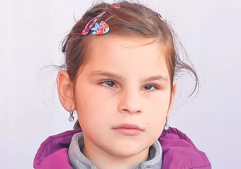 Nicoleta, operată cu succes în SUA